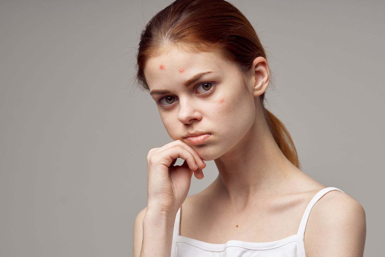 Complexion Female